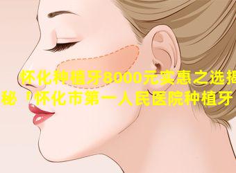 怀化种植牙8000元实惠之选揭秘「怀化市第一人民医院种植牙 🐱 」